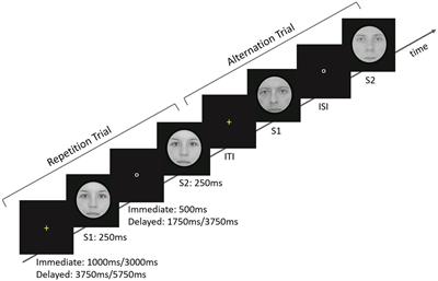 Similar Expectation Effects for Immediate and Delayed Stimulus Repetitions